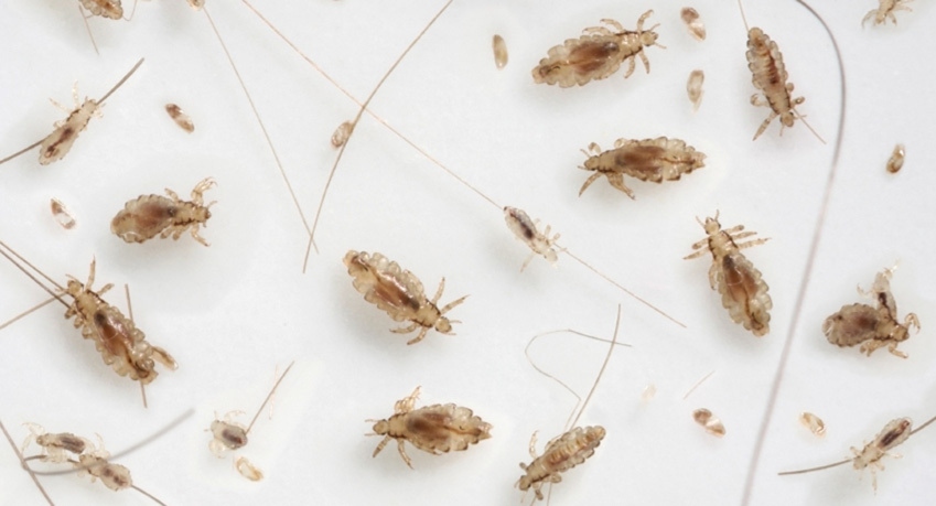 Everything to Know About Head Lice and How to Get Rid of Them from Your Kid's Hair